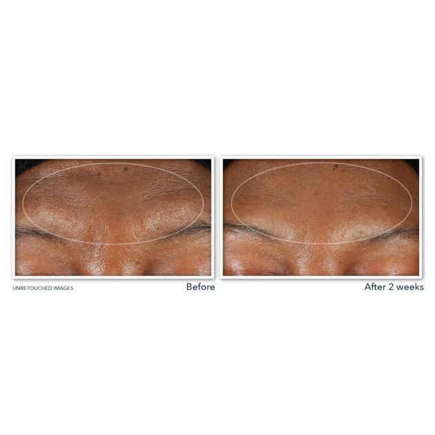 RoC Retinol Correxion Deep Wrinkle Serum Facial Cleanser